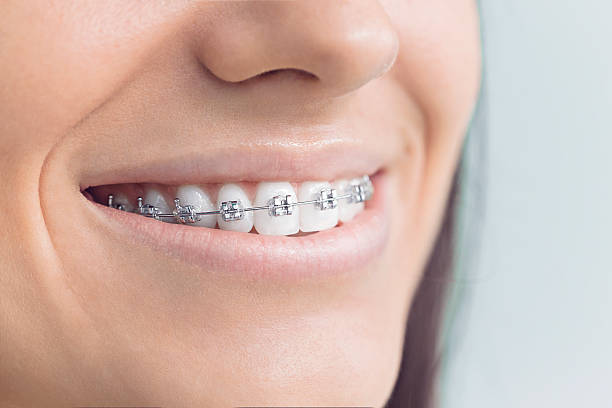 Best Full Mouth Reconstruction  in Lincolnton, GA